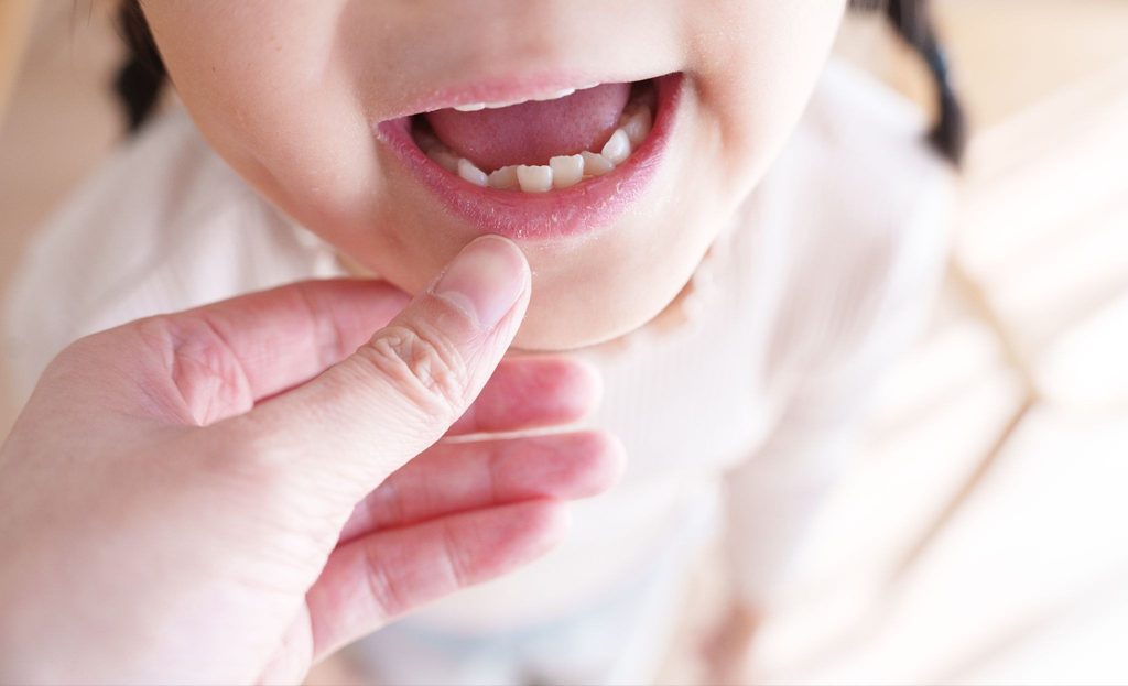子どもの口の中をチェックしようとしている大人の手