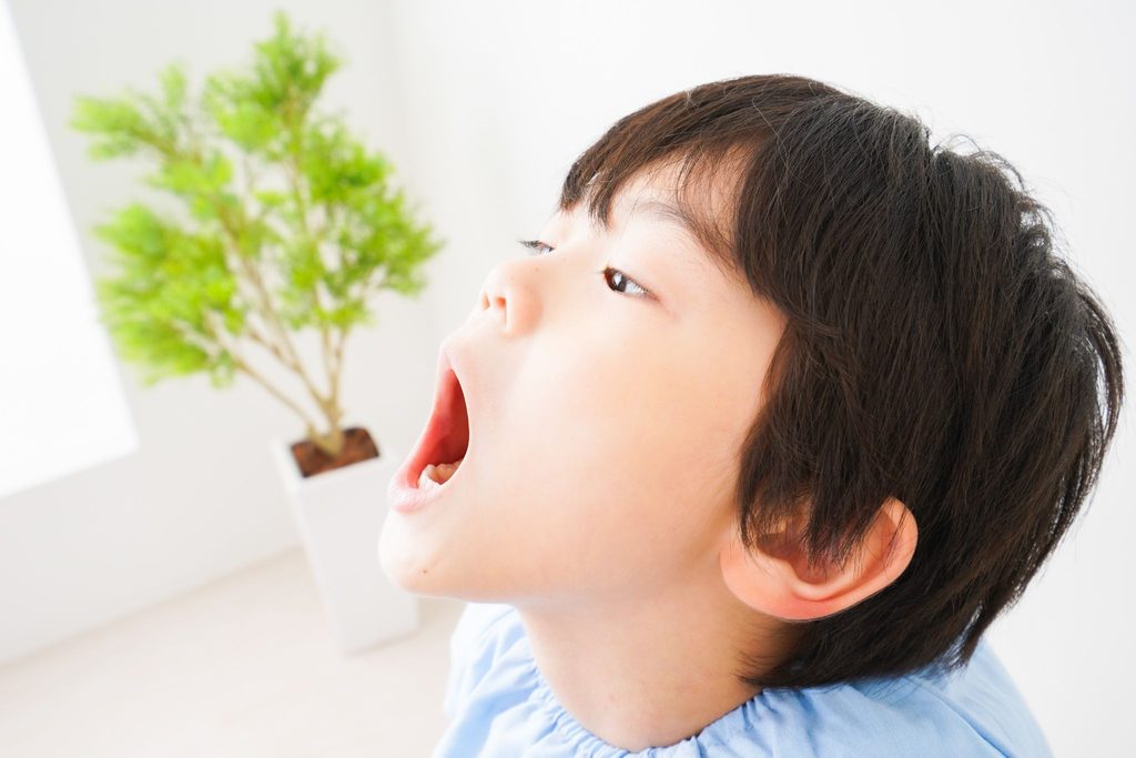 口を開けて歯科検診を受けている子ども
