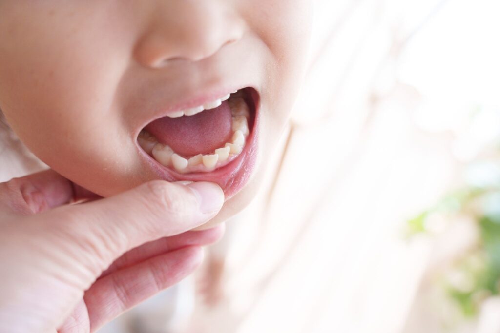 大人が子ども口元に手を添えて口の中を確認している様子