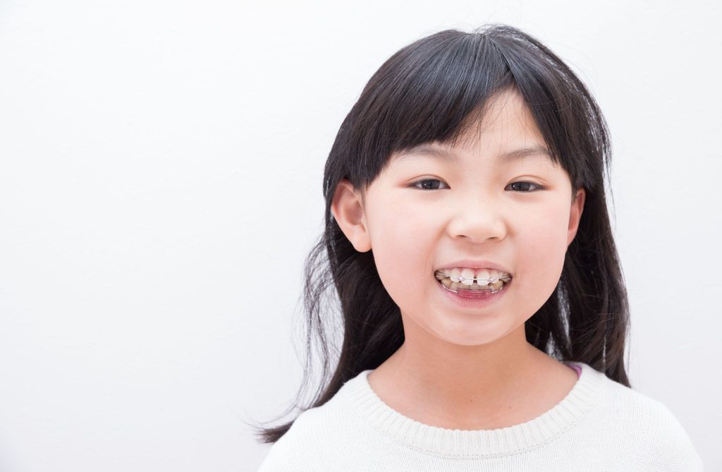 矯正装置を装着した子供