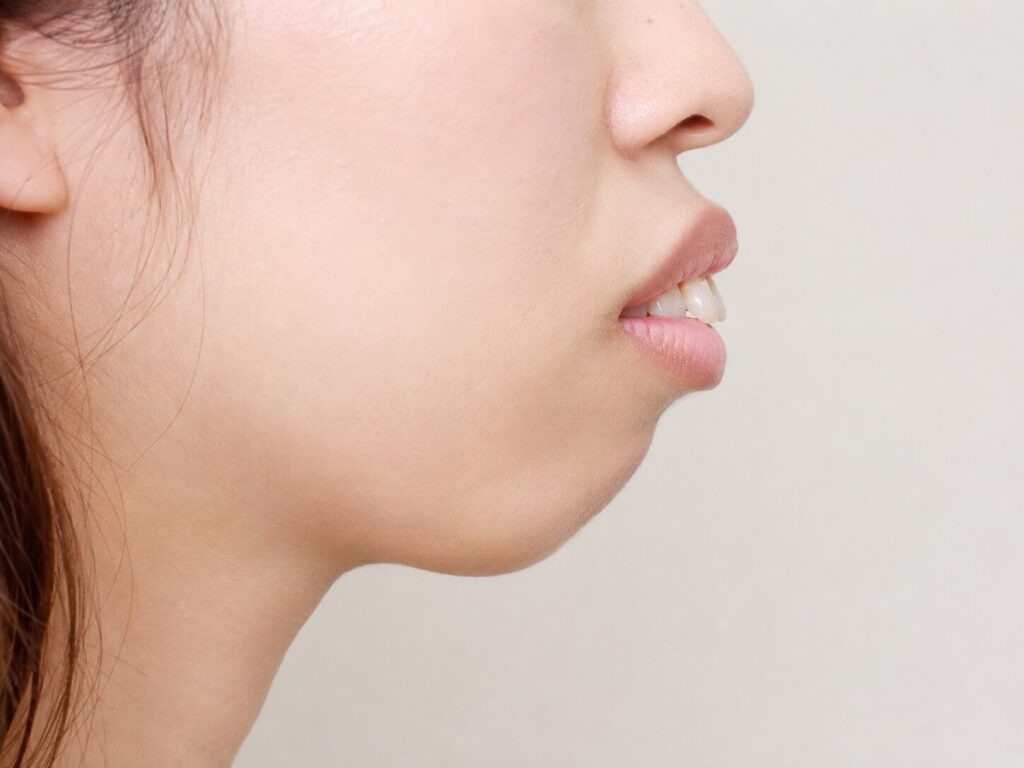 口ゴボ（上下顎前突）の女性の横顔